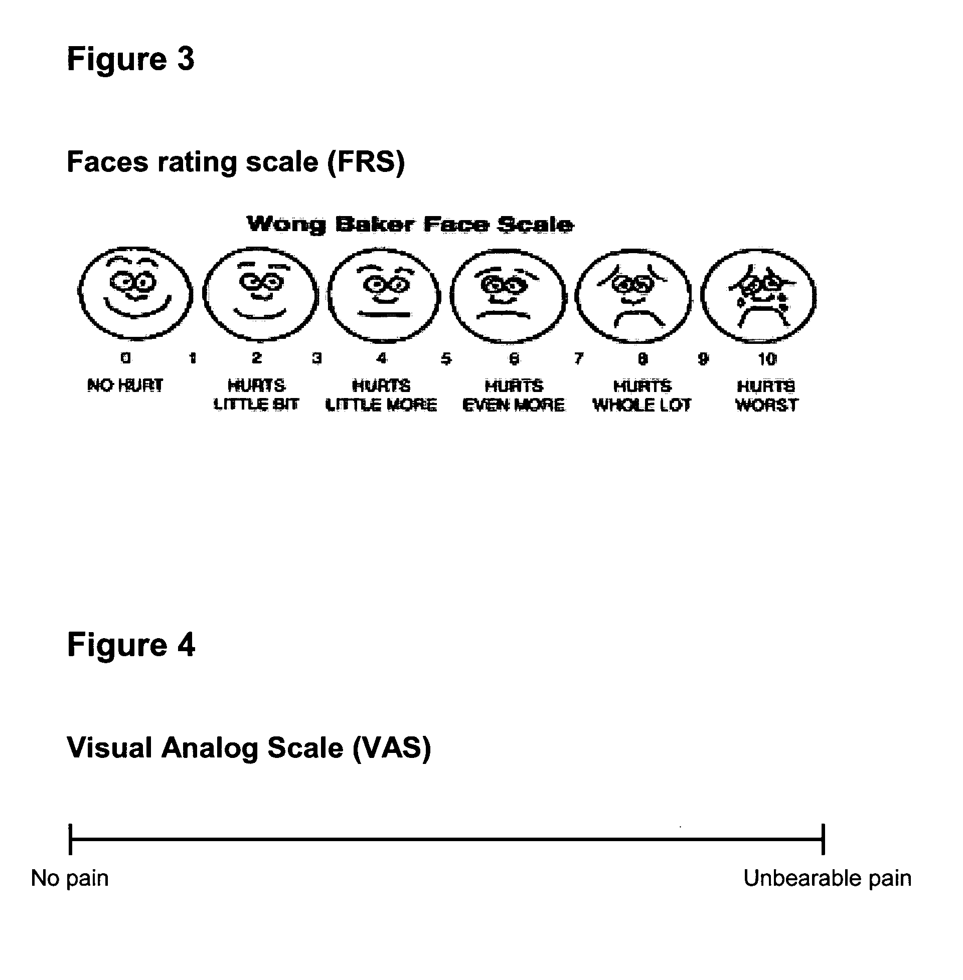 Method and device for determining the severity of a pain disorder