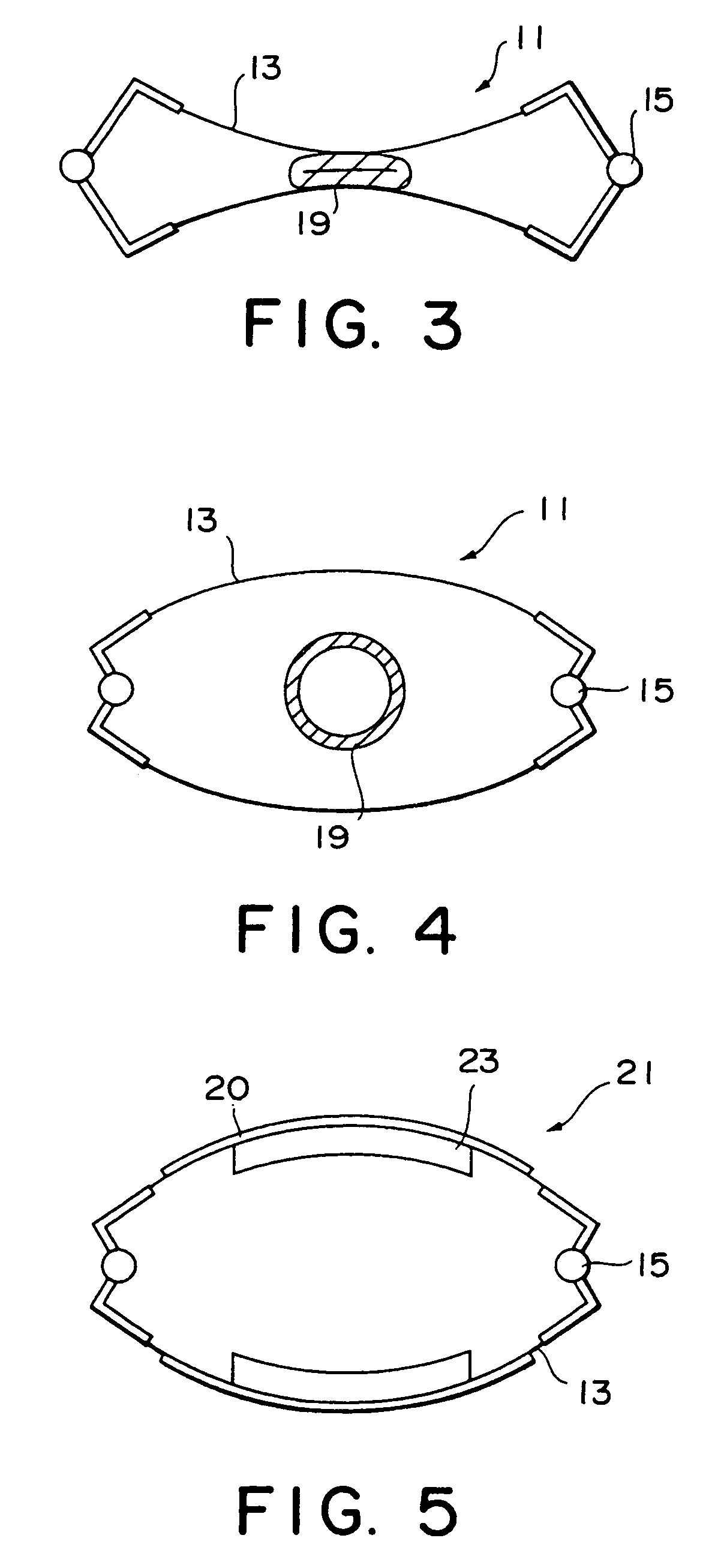 Artificial sphincter