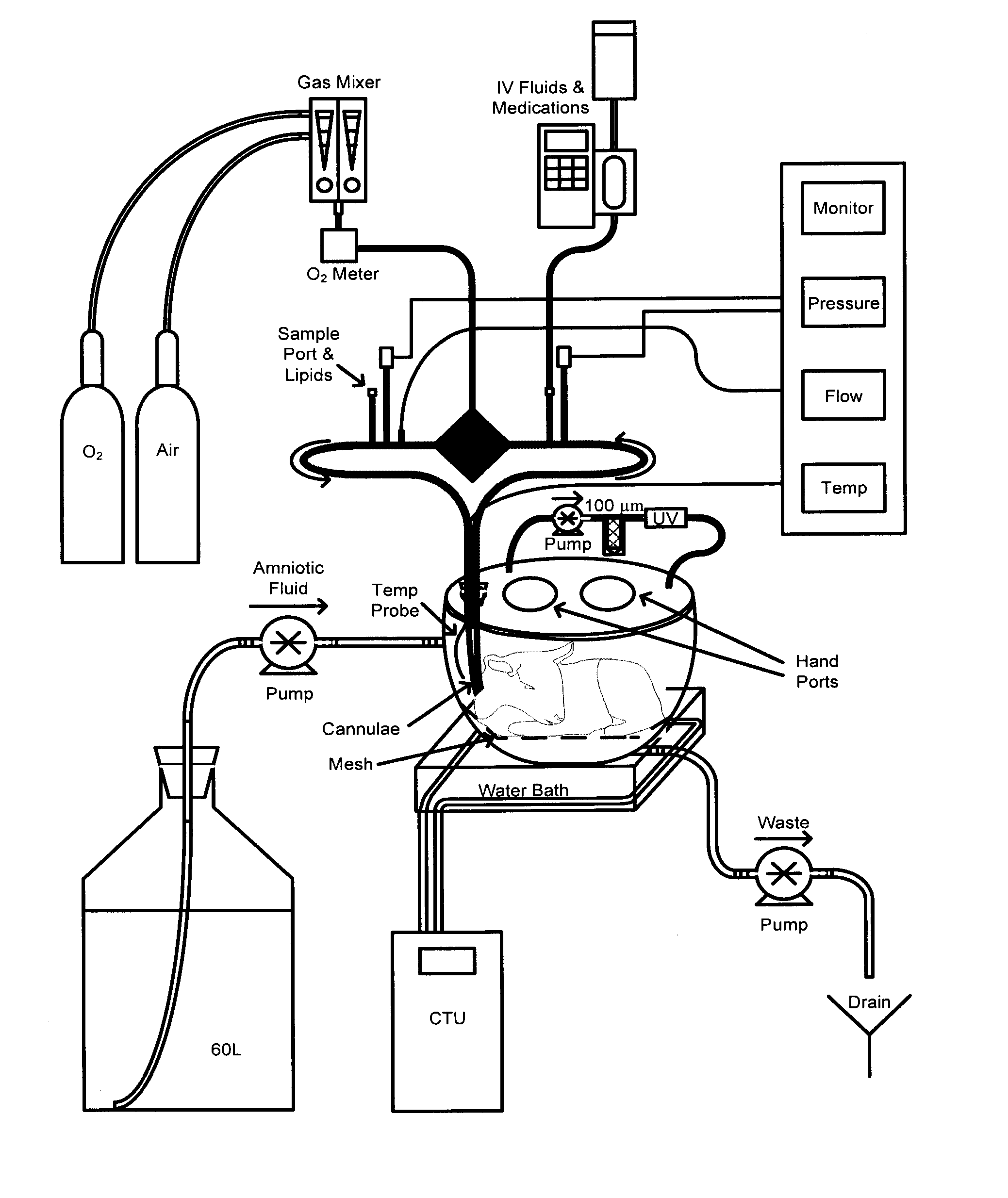 Extracorporeal life support system and methods of use thereof