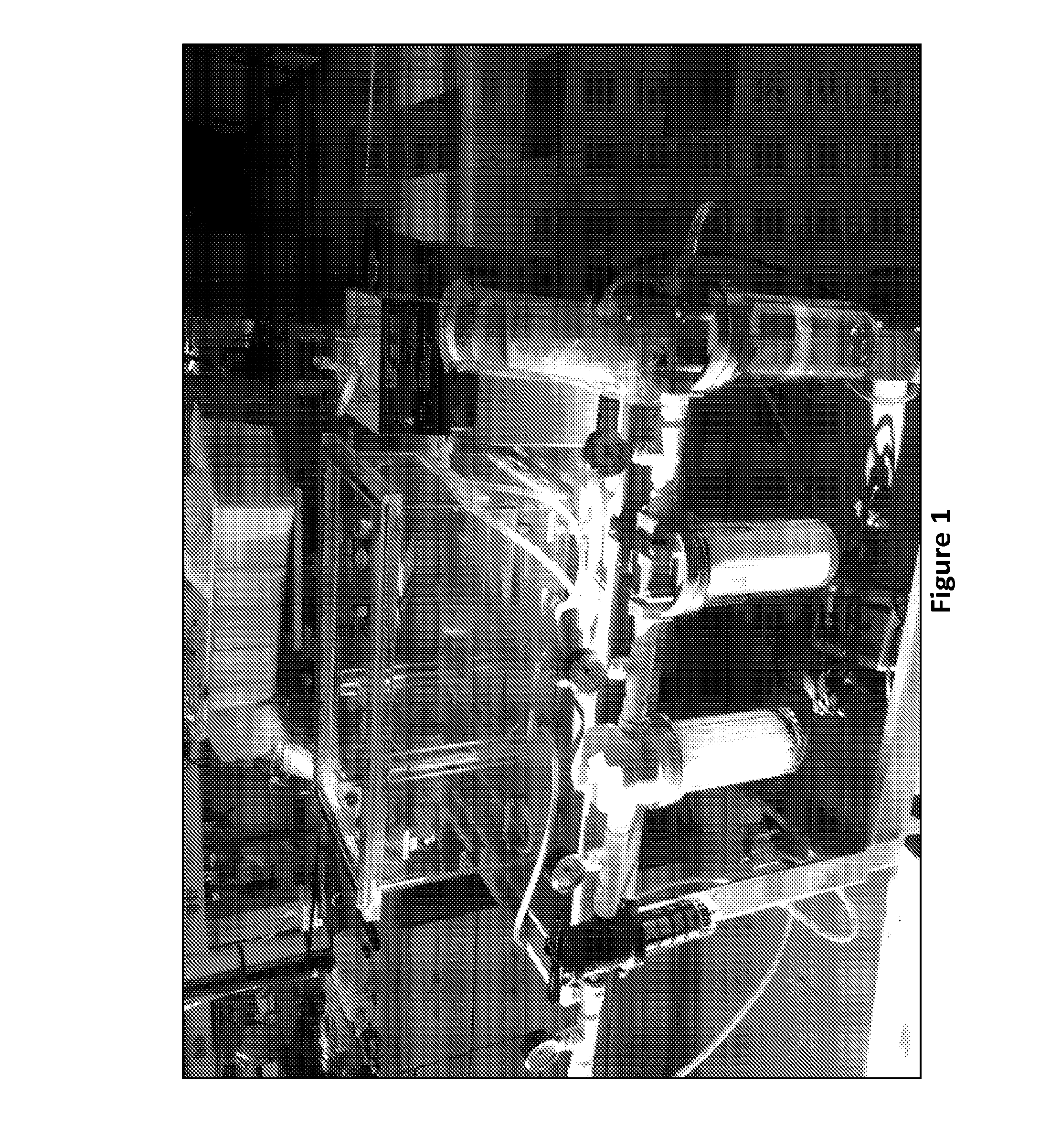 Extracorporeal life support system and methods of use thereof