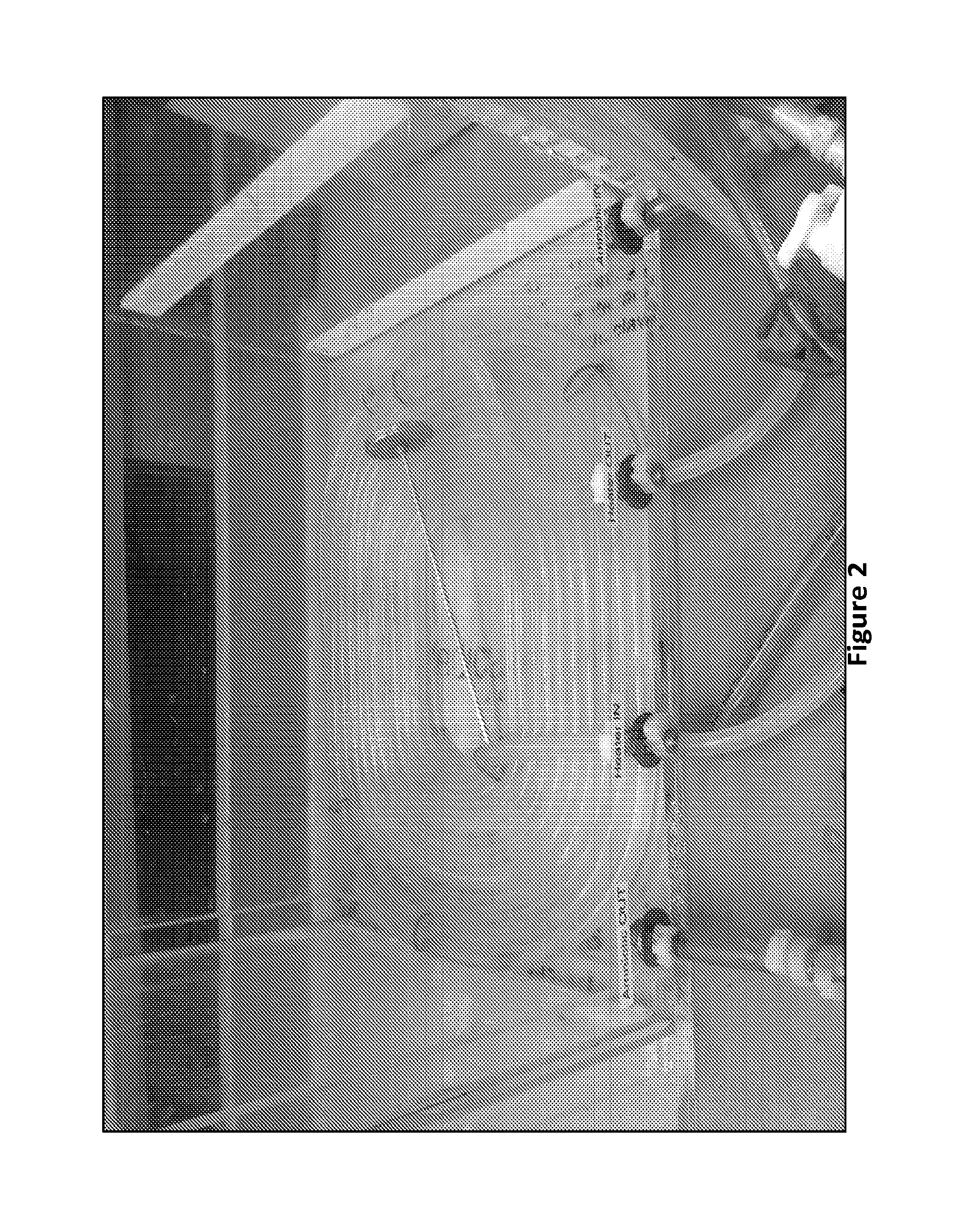 Extracorporeal life support system and methods of use thereof