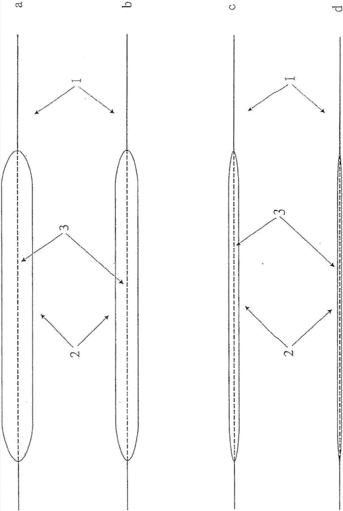 Cutback method for intravascular dilation catheter