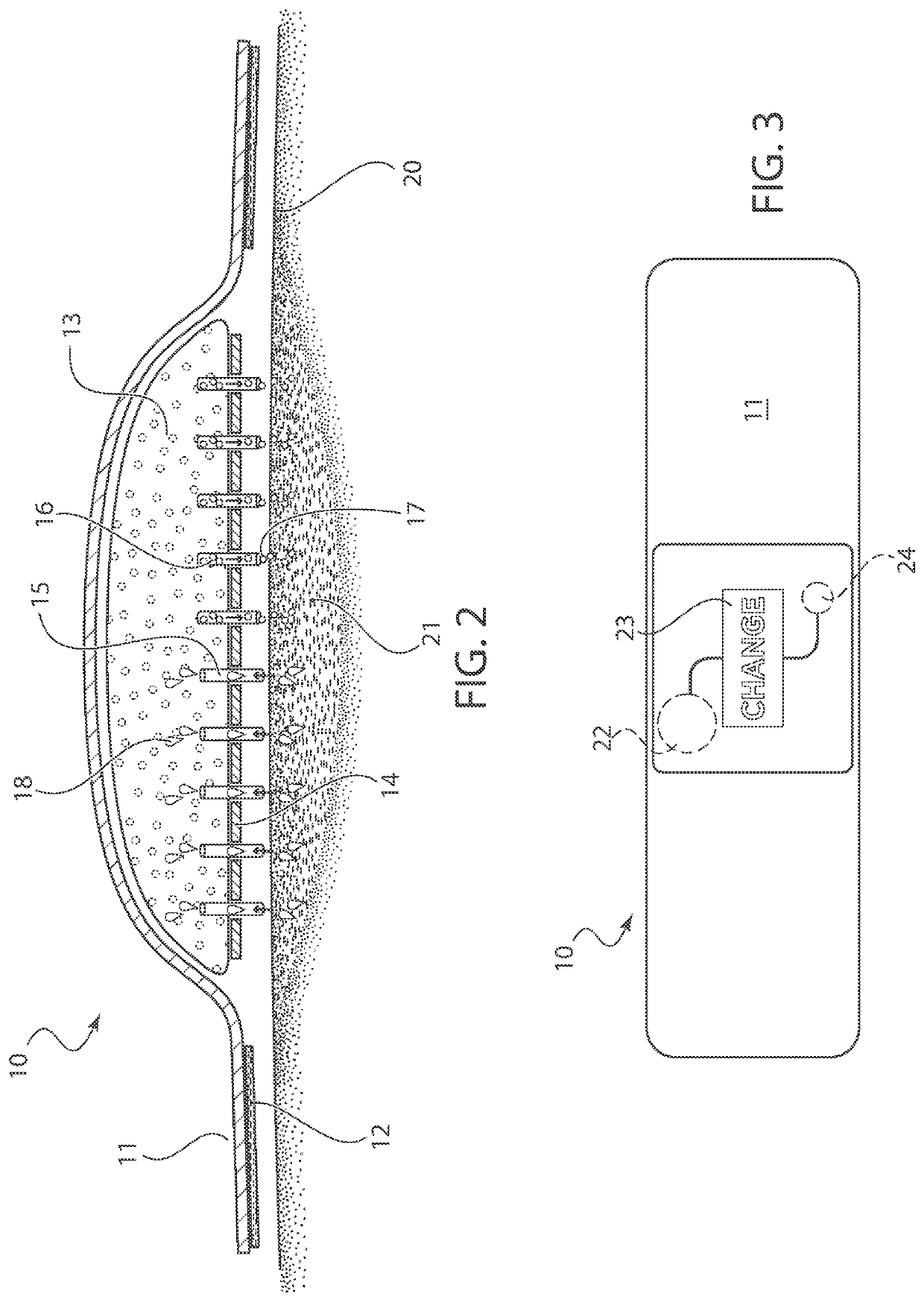 Bandage with UV disinfectant and microneedles for antimicrobial delivery and fluid absorption from a wound