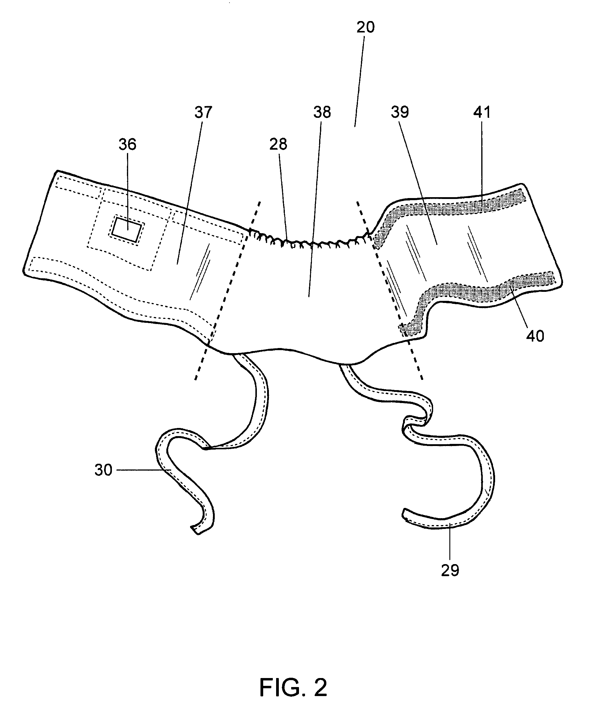 Gastrostomy garment