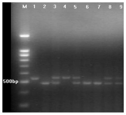 Construction method and application of age-dependent hepatitis B mouse model system of a kind of balb/c background