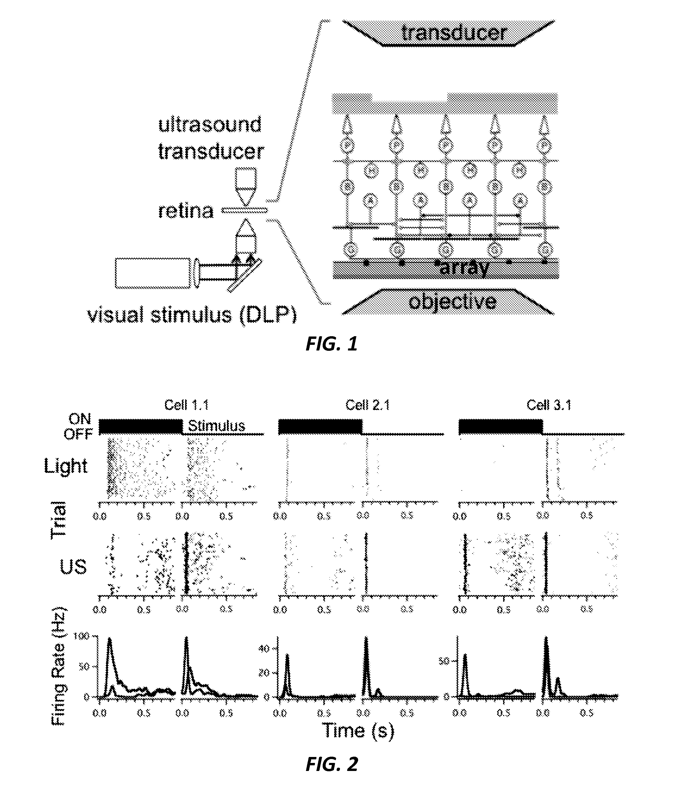 Noninvasive Ultrasound-Based Retinal Stimulator: Ultrasonic Eye