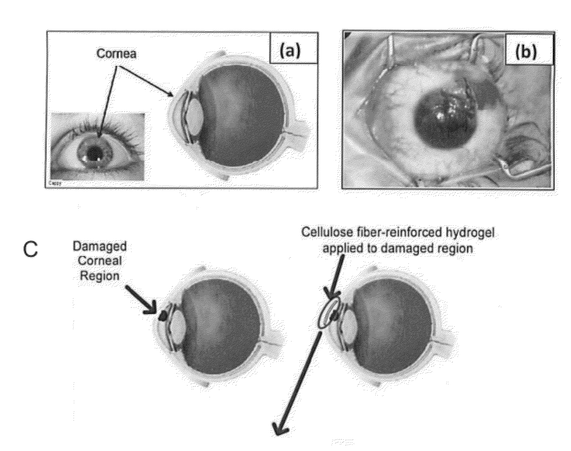 Wound Healing Compositions Comprising Biocompatible Cellulose Hydrogel Membranes and Methods of Use Thereof