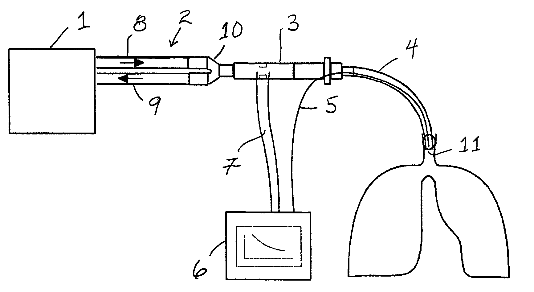 Method for monitoring lung collapse