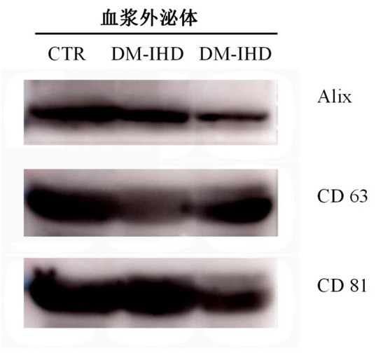 Exosome miRNA as molecular marker for diagnosing type 2 diabetes mellitus complicated with coronary heart disease and application thereof