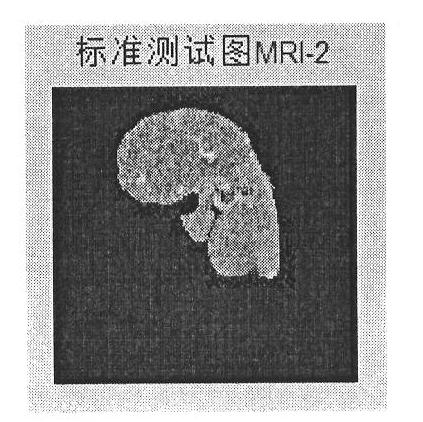 DCT (discrete cosine transform)-based anti-geometric-attack zero-digital-watermarking method for medical image