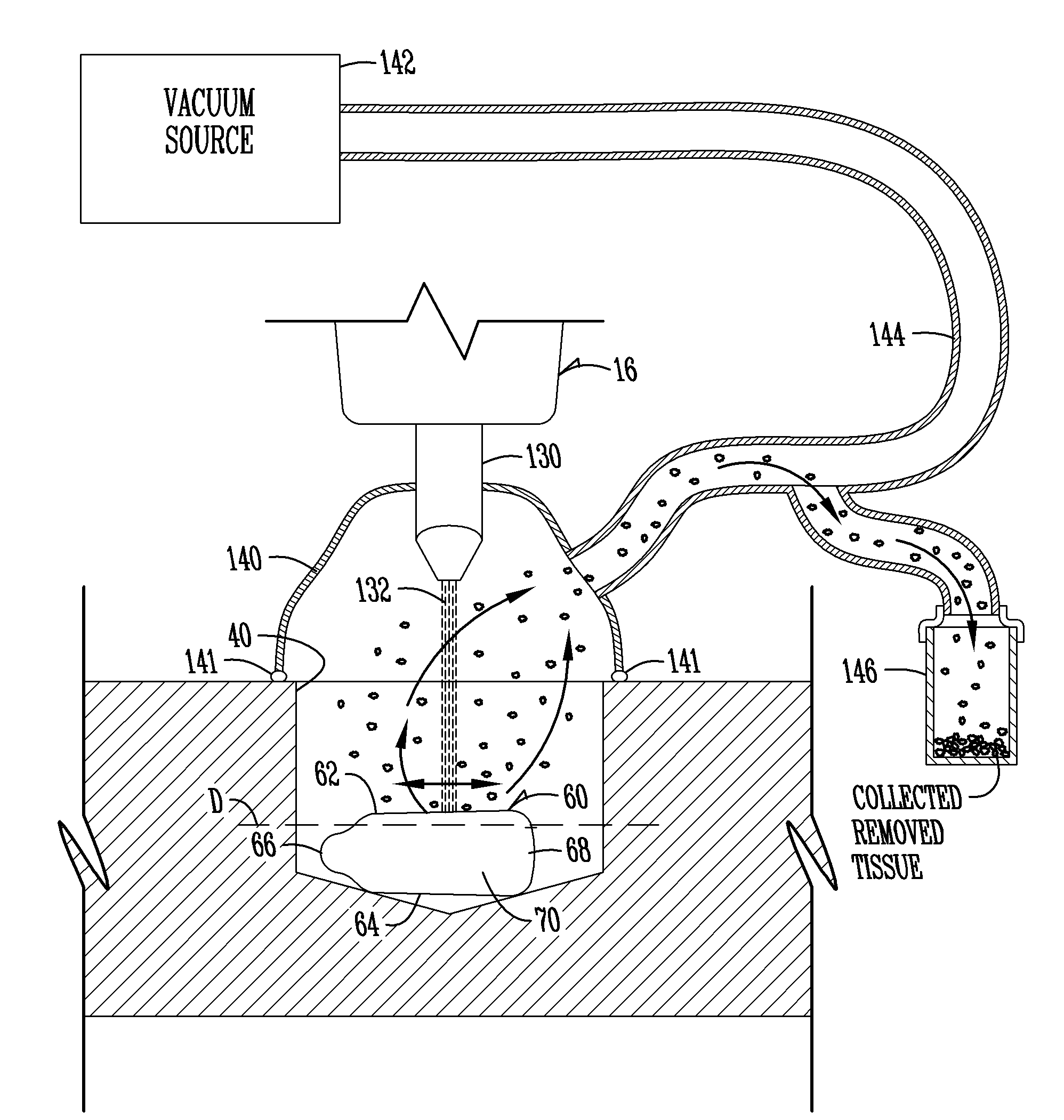 Methods for removal of specific seed tissue or structure for seed analysis