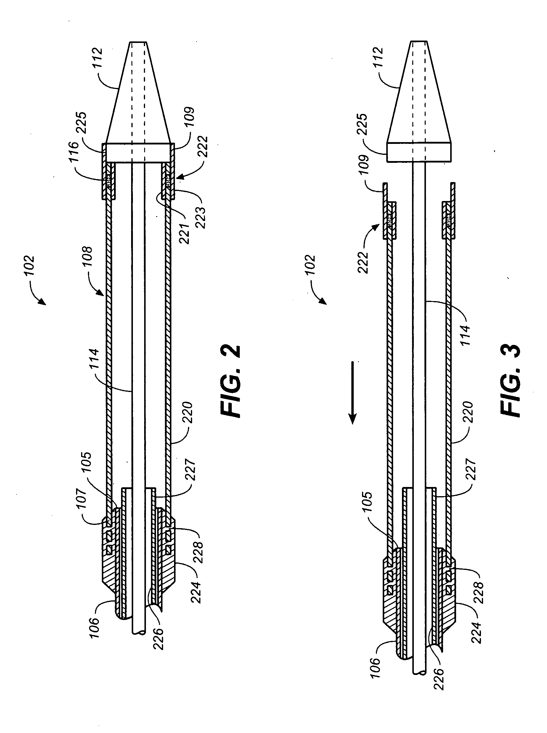 Endovascular Delivery System Having Textile Component for Implant Restraint and Delivery