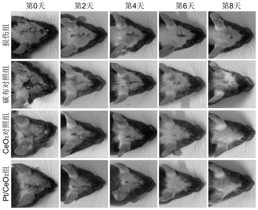 A single-atom nano-enzyme patch for skin wounds and its preparation method