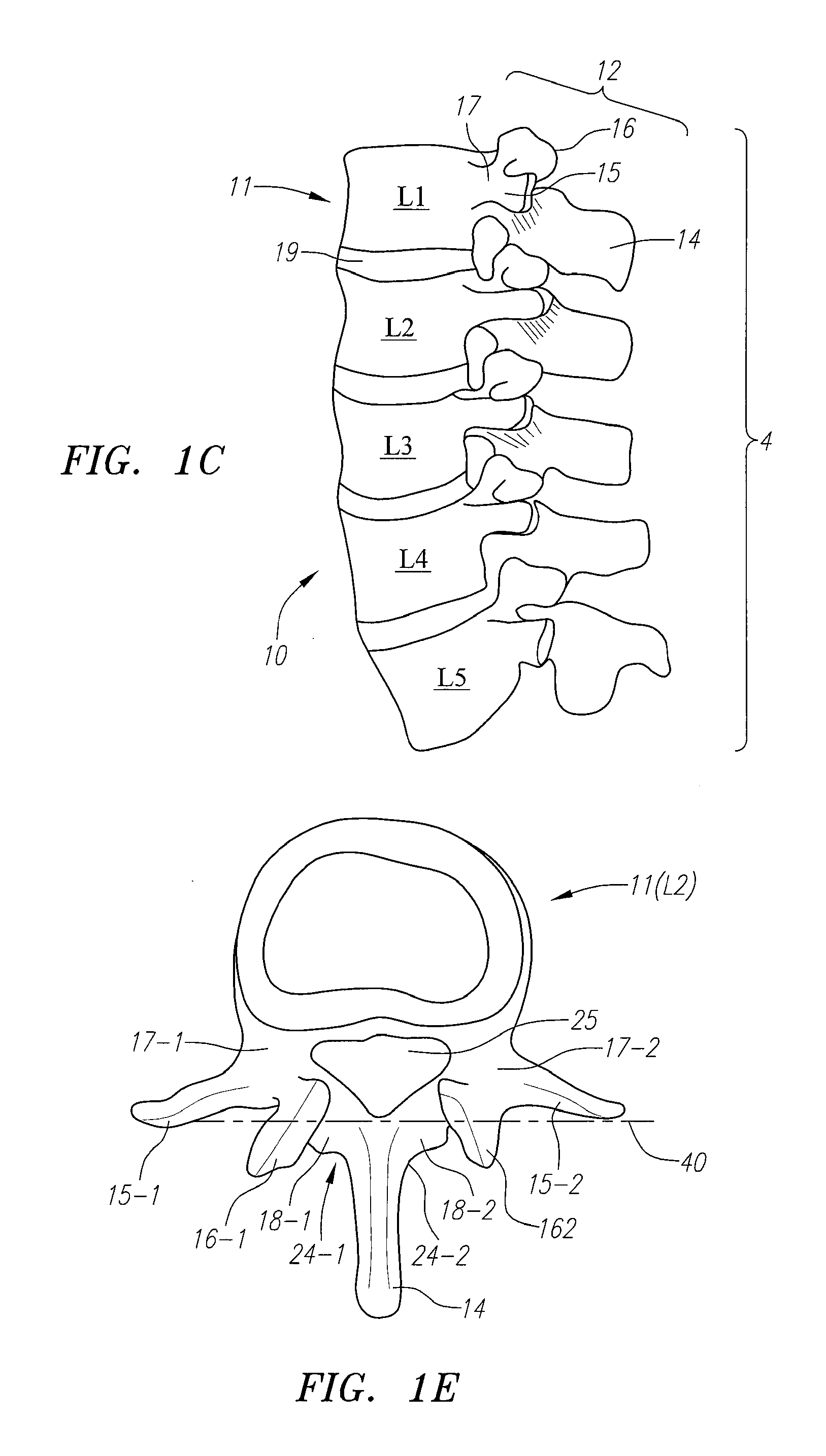 Systems, Devices and Methods for the Correction of Spinal Deformities