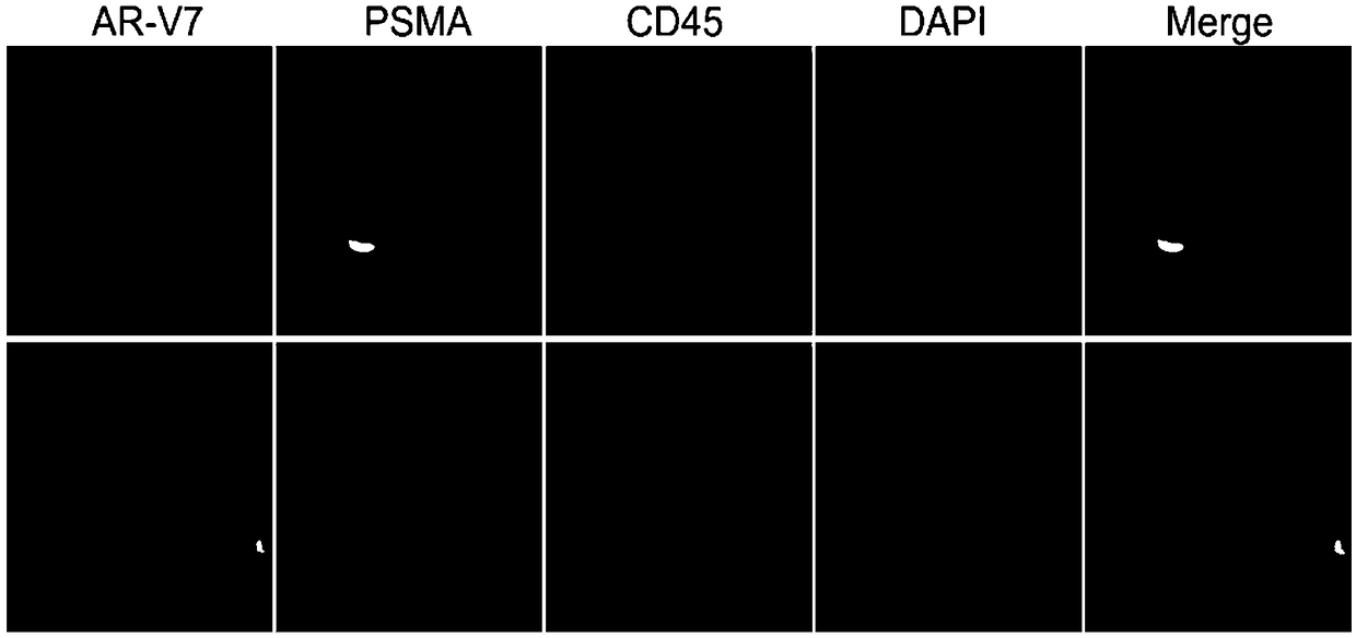 Immunofluorescence kit for detecting human prostate cancer antigens PSMA and AR-V7 and application