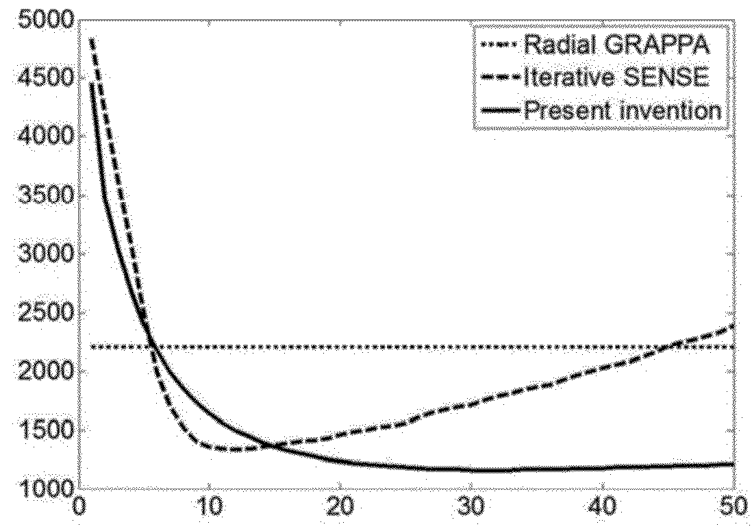 Parallel magnetic resonance imaging method for radial trajectory