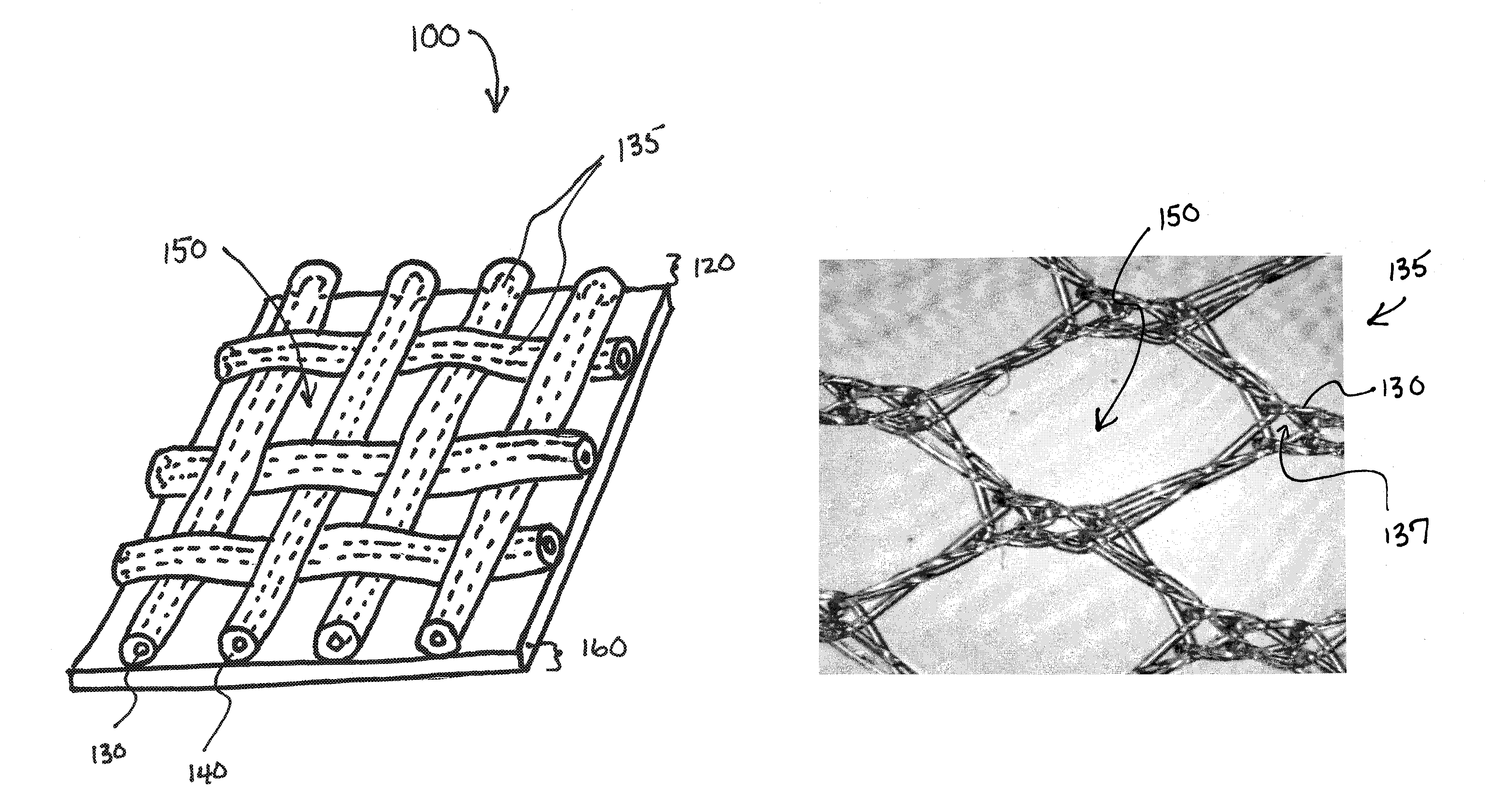 Apparatus and method for limiting surgical adhesions