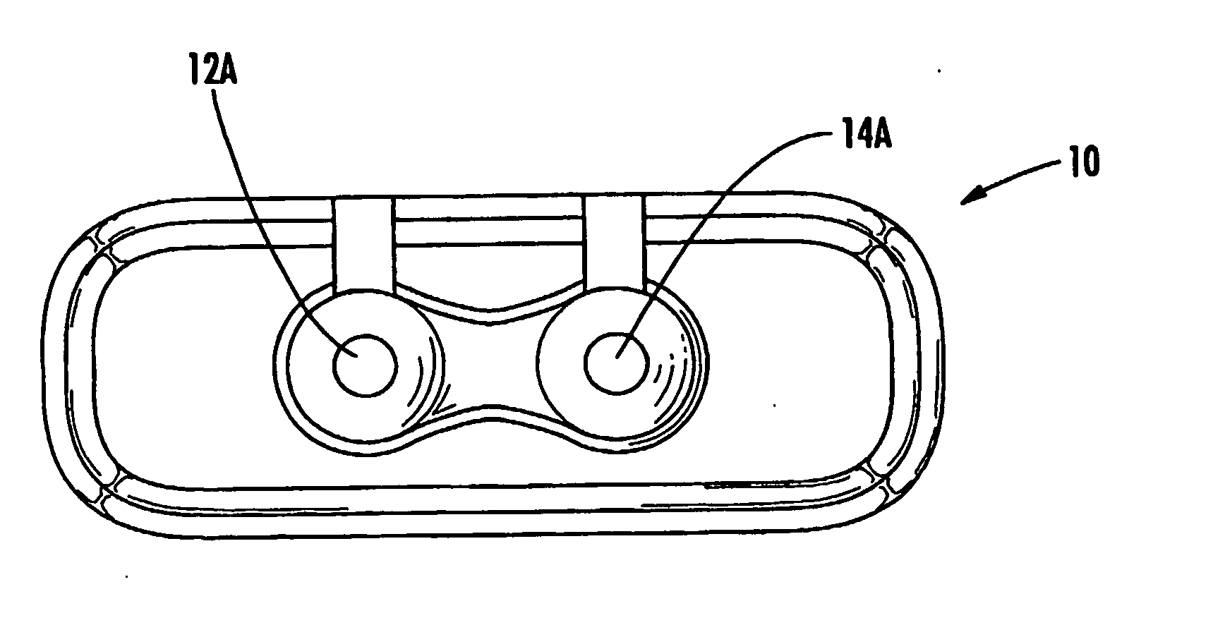 Spine replacement system for the treatment of spine instability and degenerative disc disease