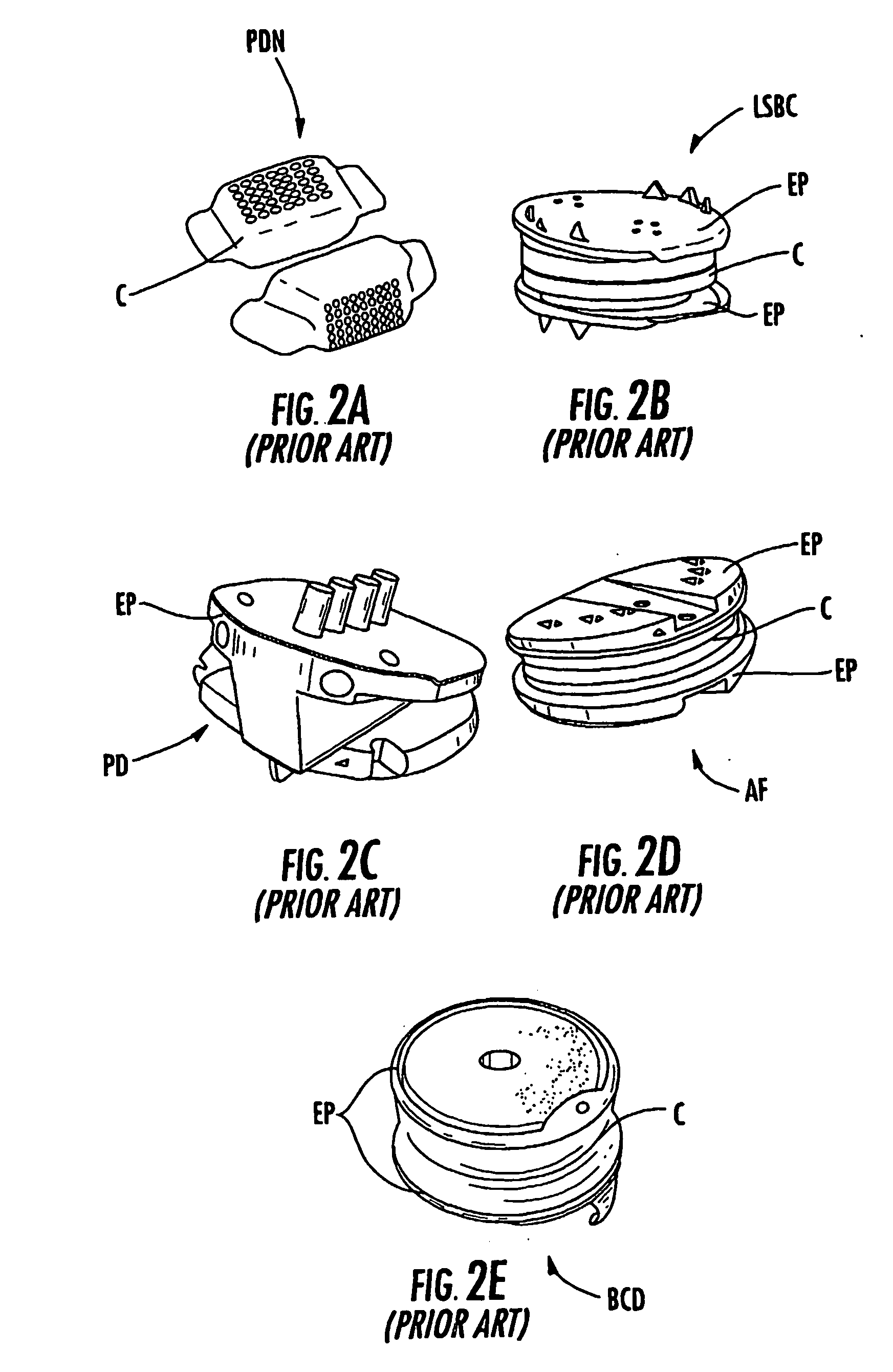 Spine replacement system for the treatment of spine instability and degenerative disc disease