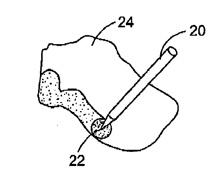 System and methods for using a dynamic gamma knife for radiosurgery