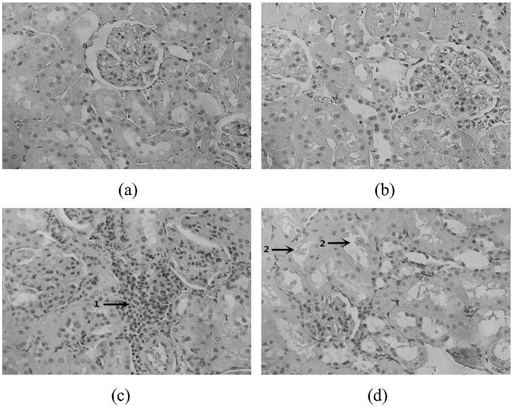 Yeast fructose composition affecting purine metabolism