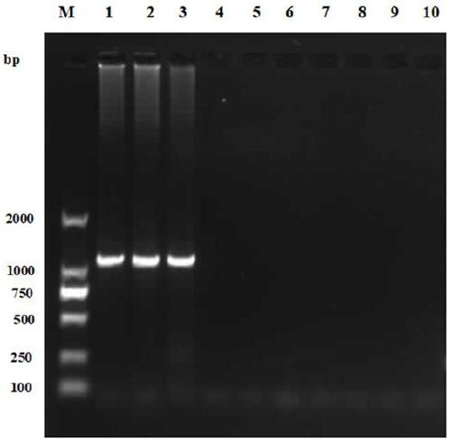 Duck hepatitis A virus universal detection kit