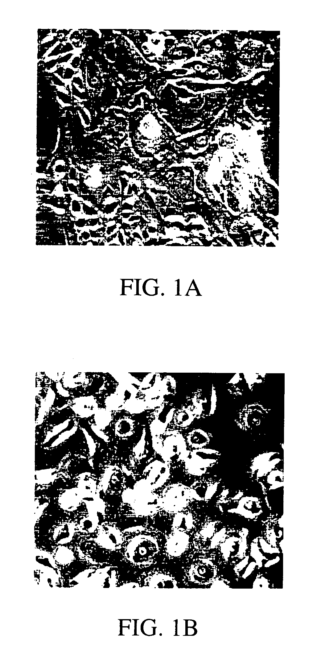 Transdiffentiation of transfected epidermal basal cells into neural progenitor cells, neuronal cells and/or glial cells