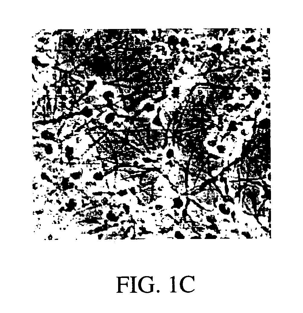 Transdiffentiation of transfected epidermal basal cells into neural progenitor cells, neuronal cells and/or glial cells