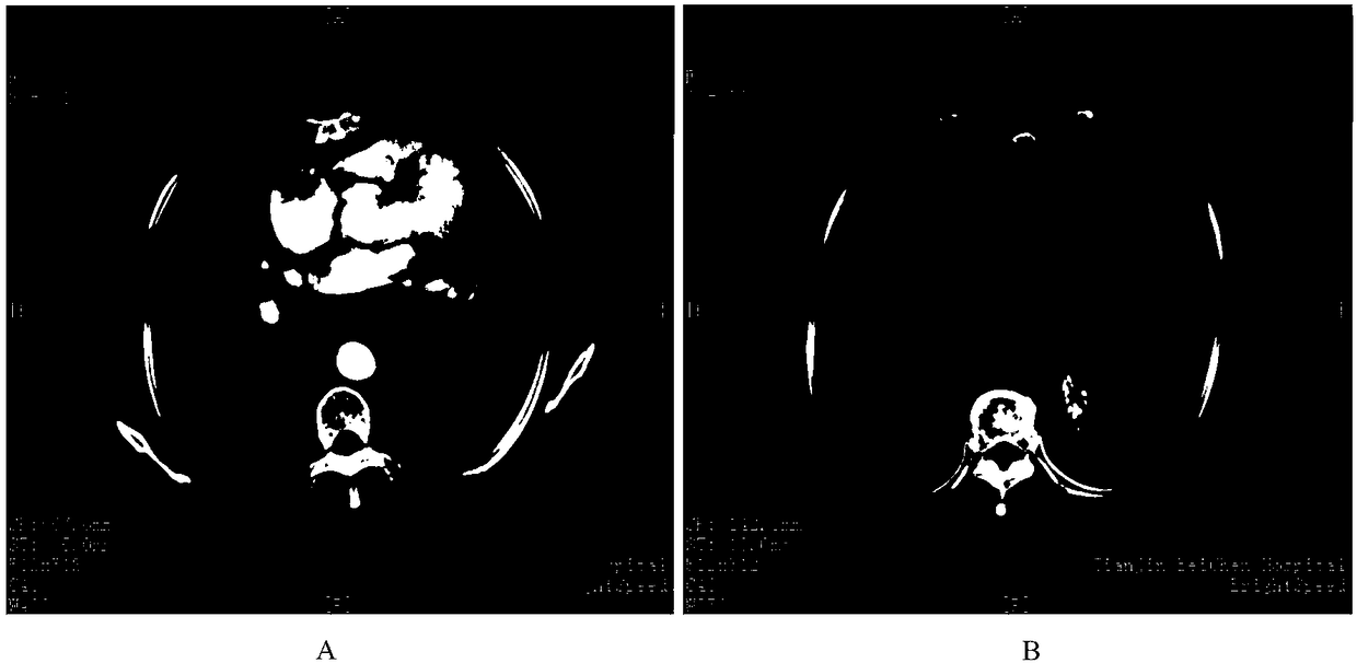 Antigen peptide chain group for treating tumor and application thereof to medicine