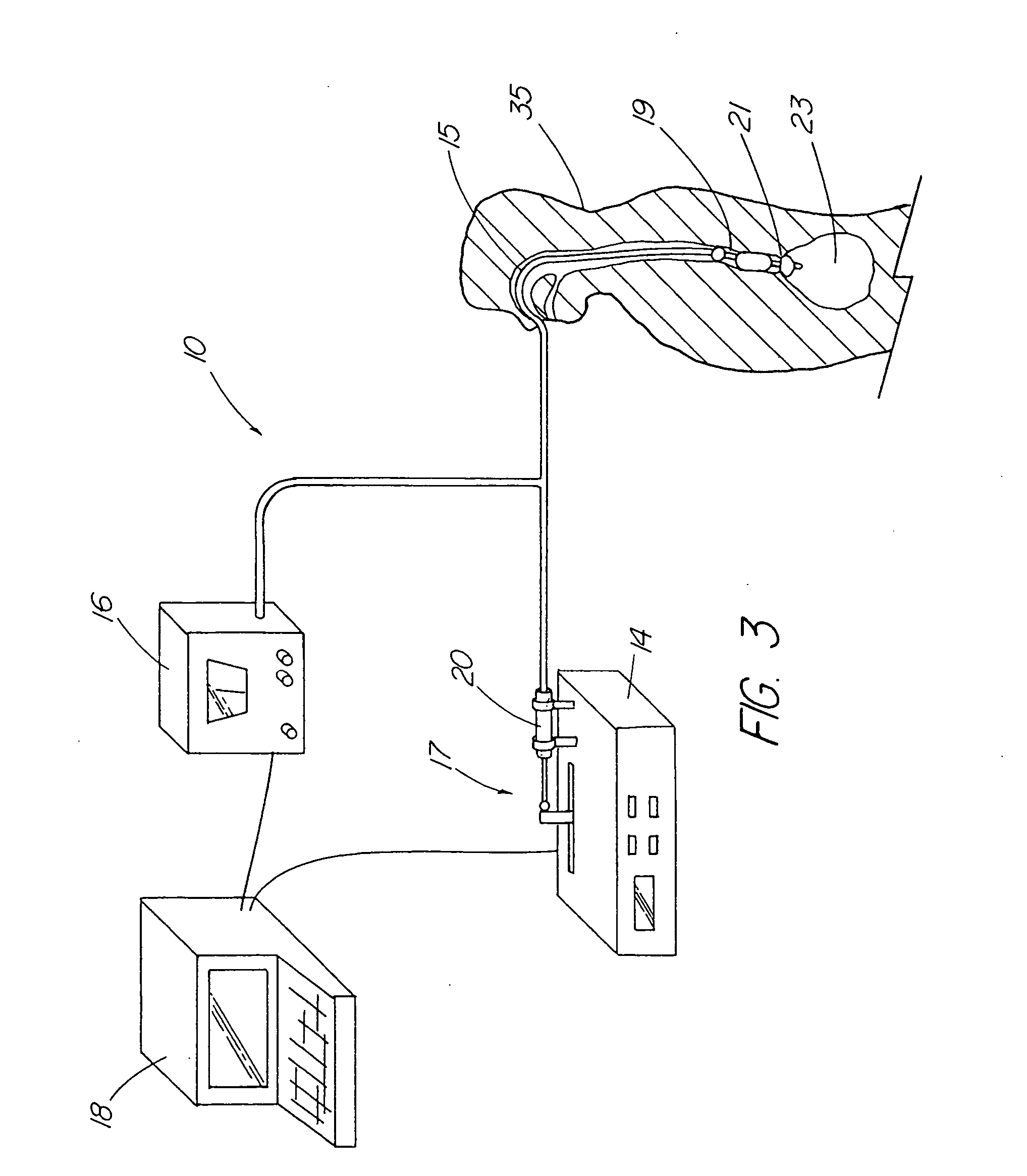 Method for measuring esophageal sphincter compliance