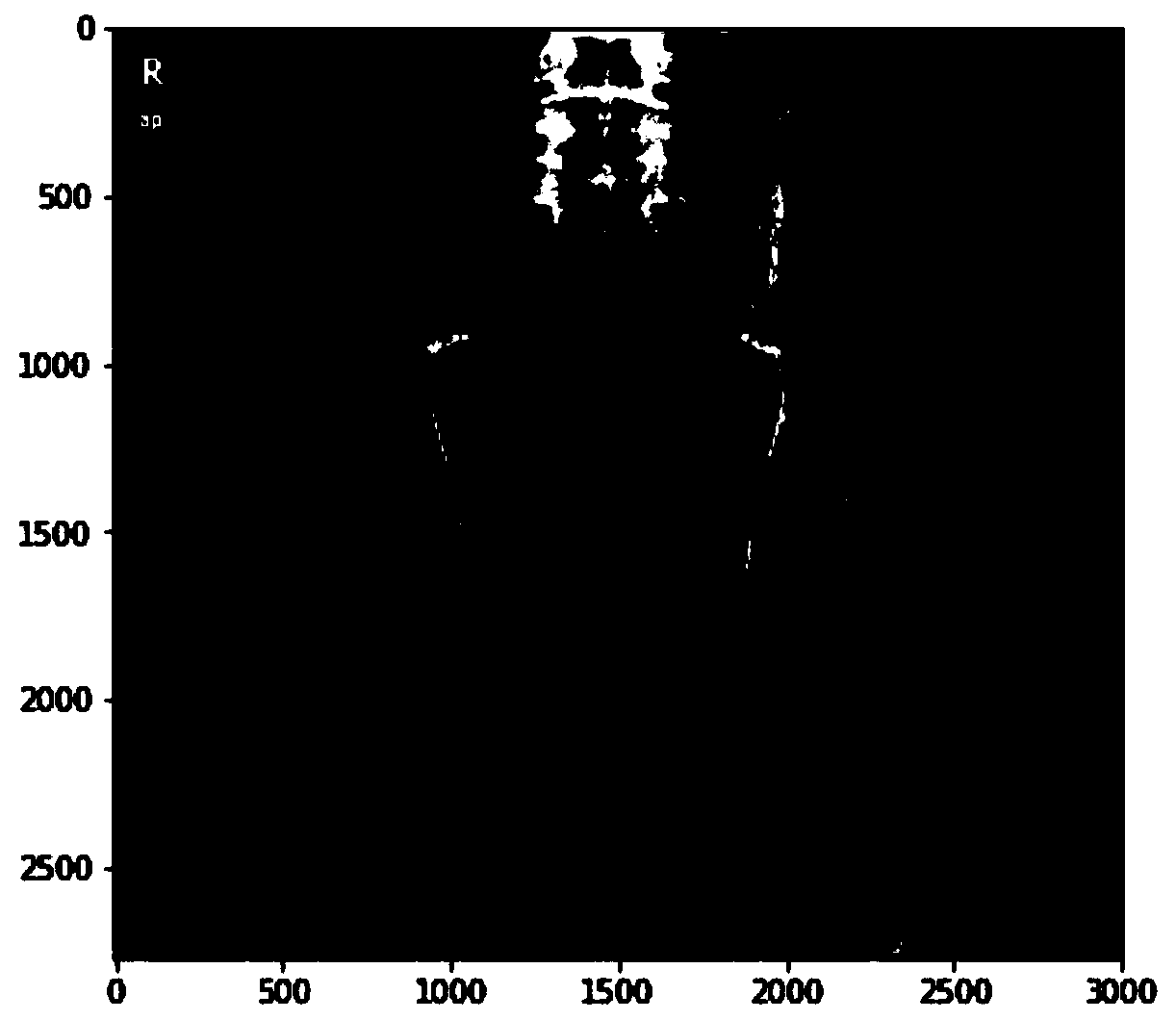 Method, system, apparatus and storage medium for measuring neck shaft angle in pelvic X-ray film