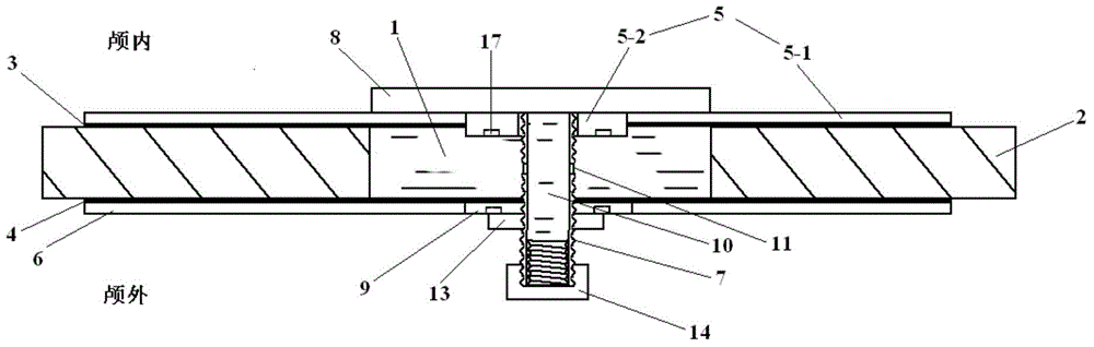 Device for repairing skull base defects