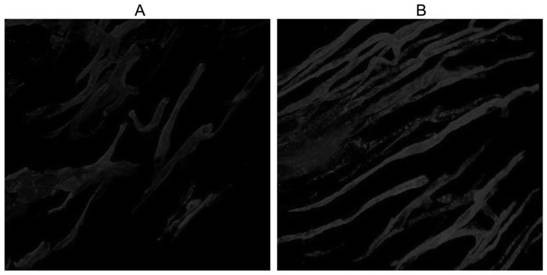 Carboxy-dii compound and its preparation method and application