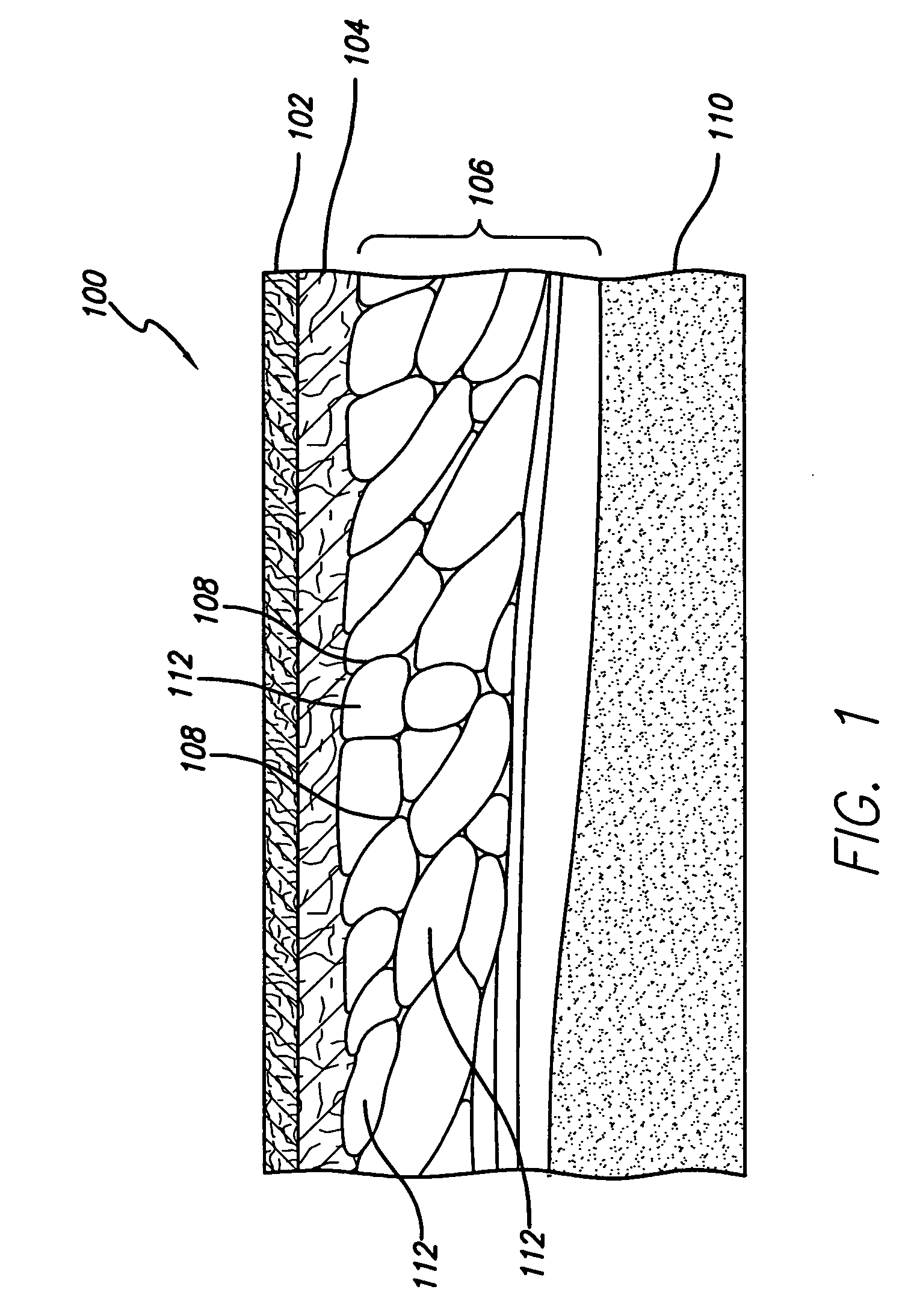 System for treating subcutaneous tissues