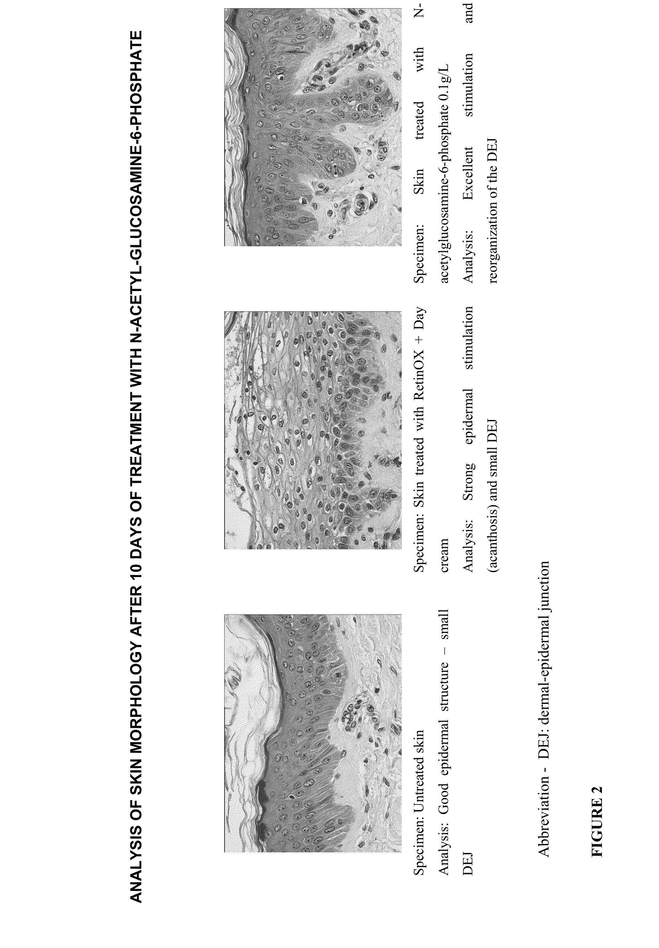 Cosmetic and Pharmaceutical Composition Comprising N-Acetylglucosamine-6-Phosphate