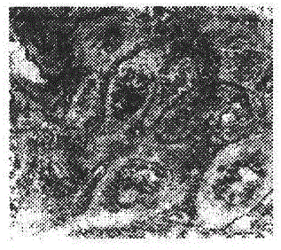 Cell microscopic imaging method, image processing method and imaging analysis system