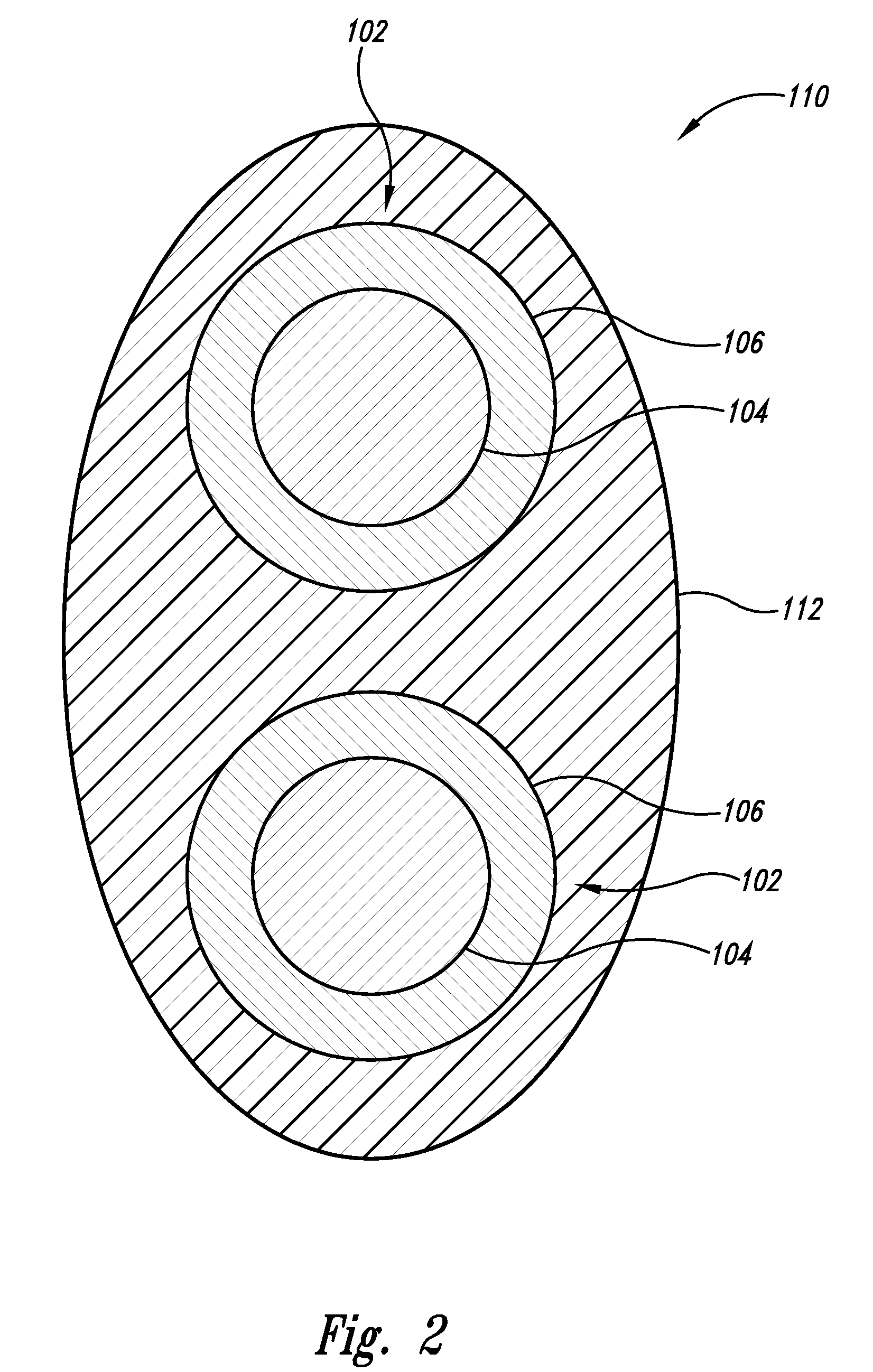 Enhanced implantable antenna method