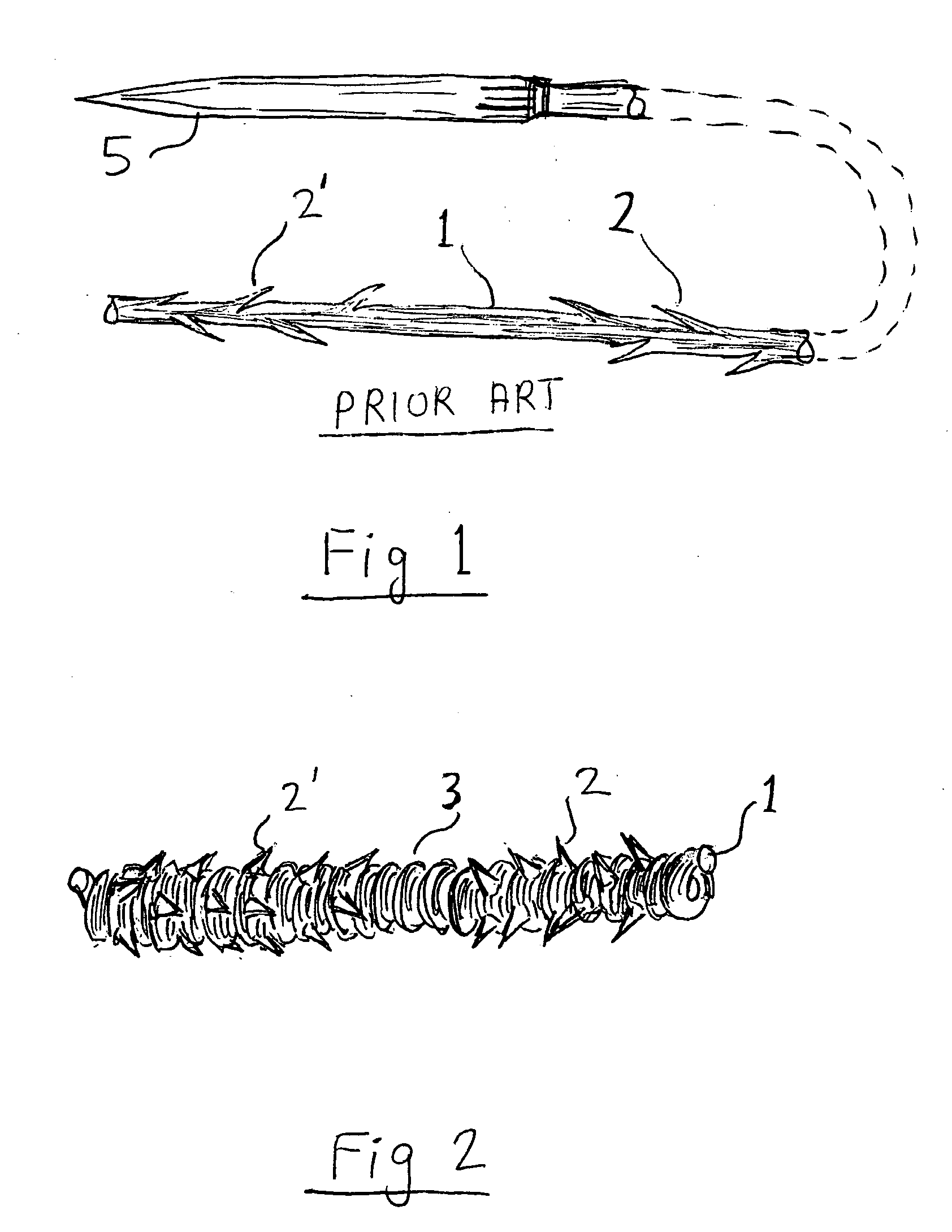 Elastic barbed suture and tissue support system