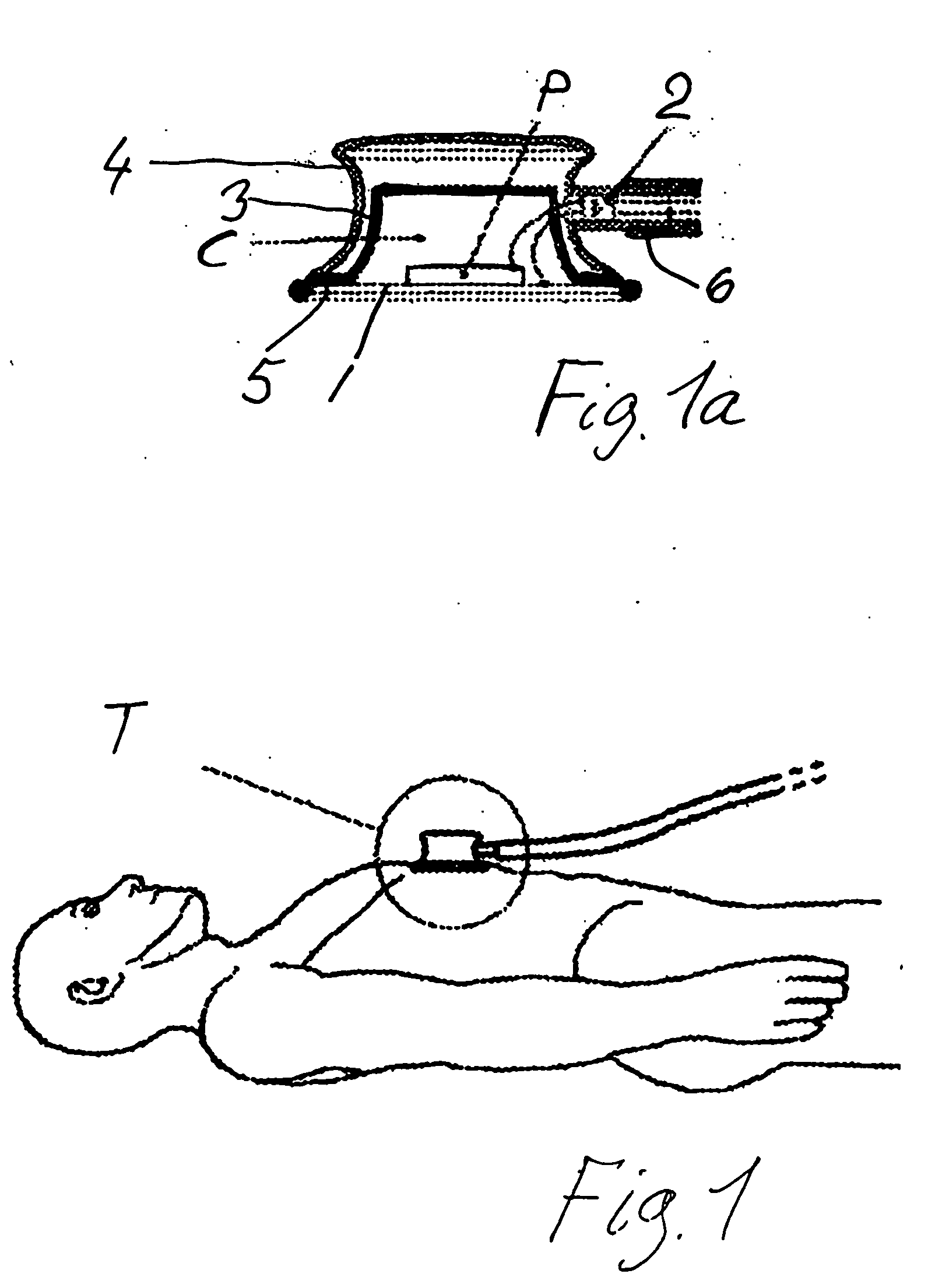 Transducer for bioacoustic signals