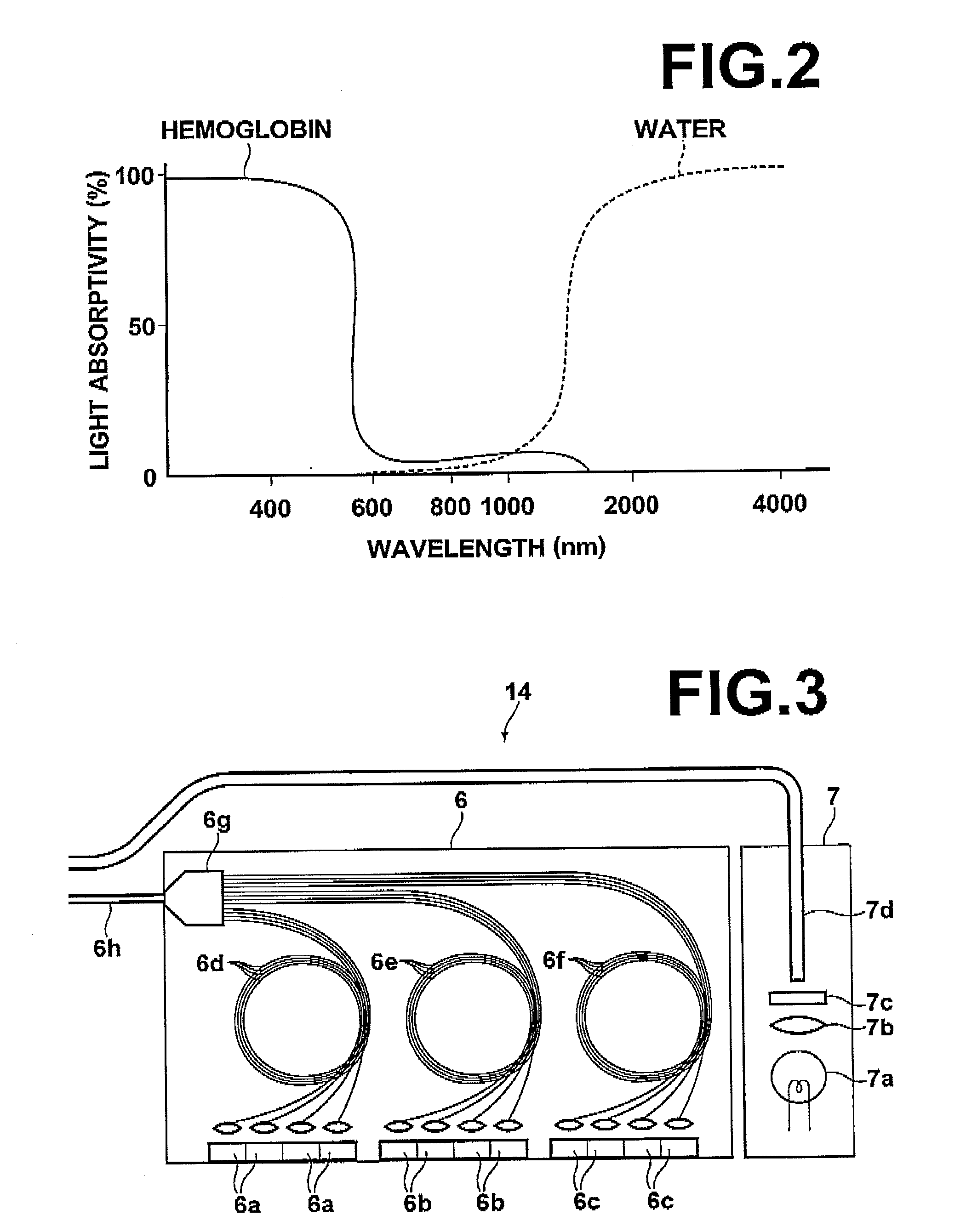 Imaging apparatus