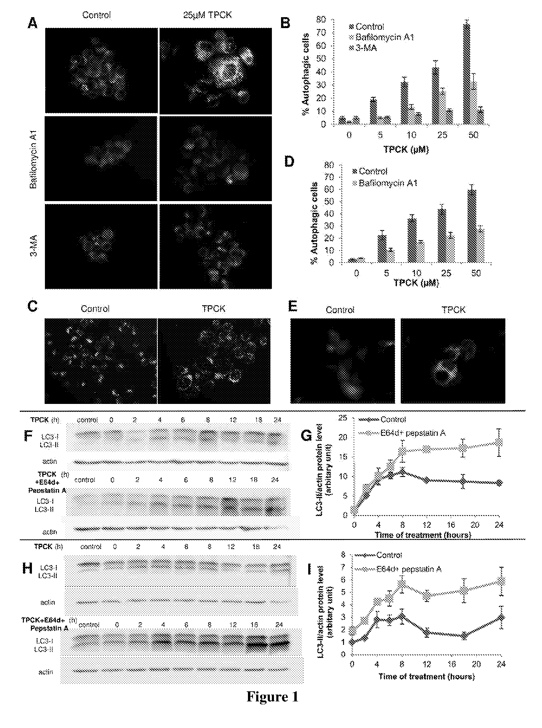 Compositions and methods for modulating autophagic cell death