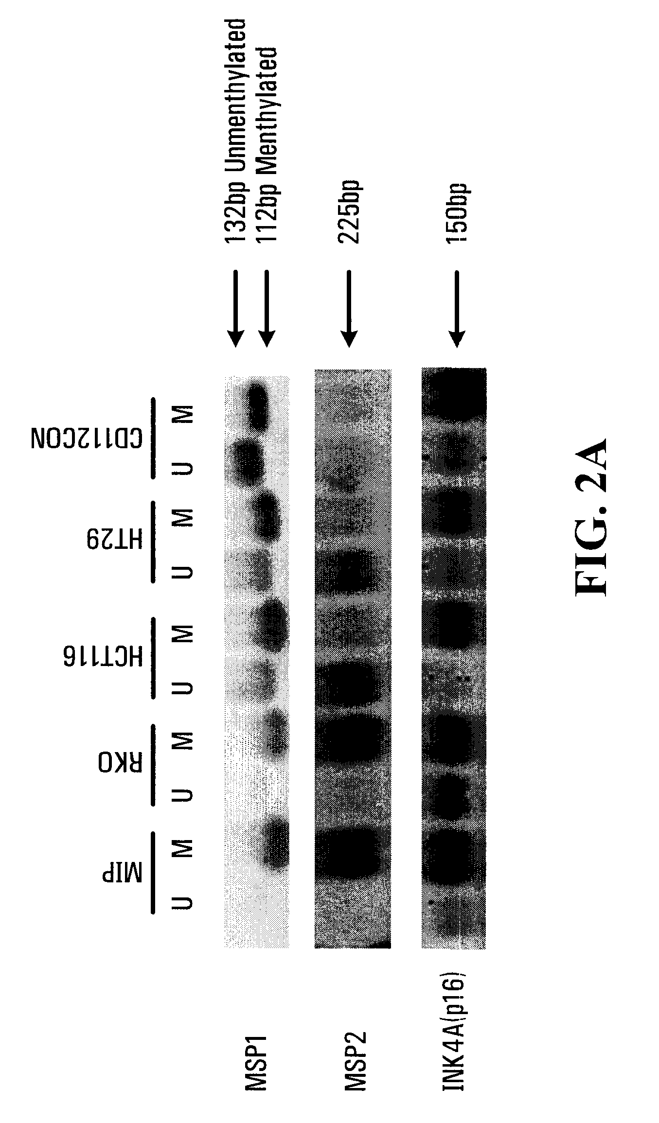 Assessing Chemotherapy Resistance of Colorectal Tumors by Determining Sparc Hypermethylation