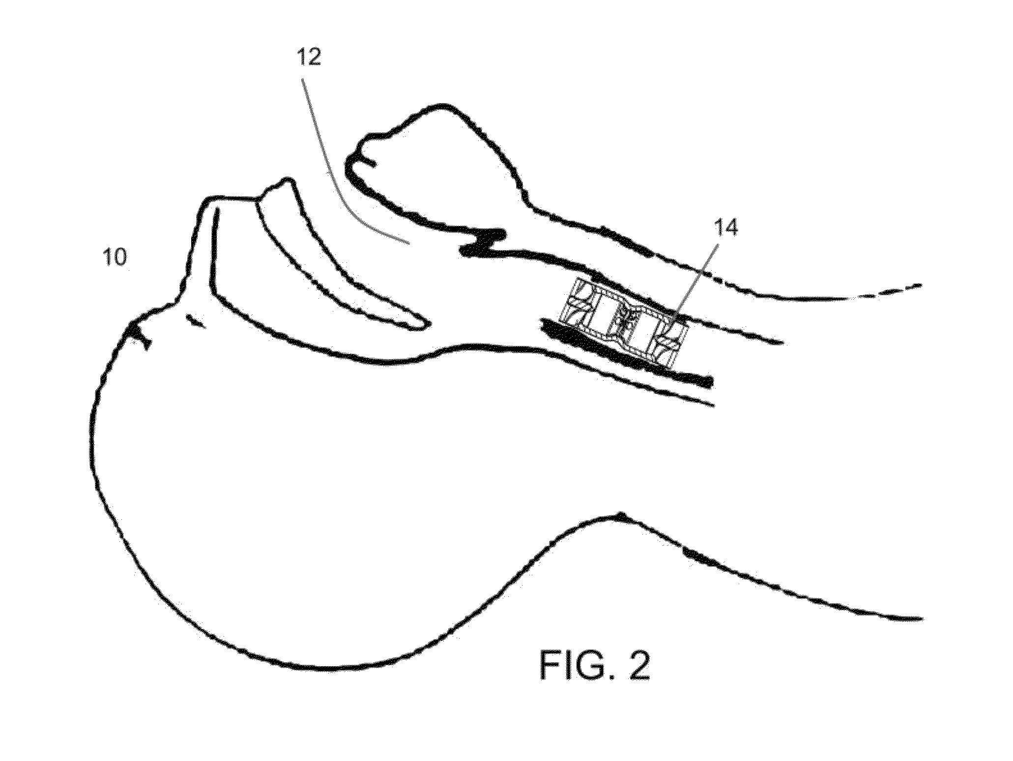 Apparatus for infection control