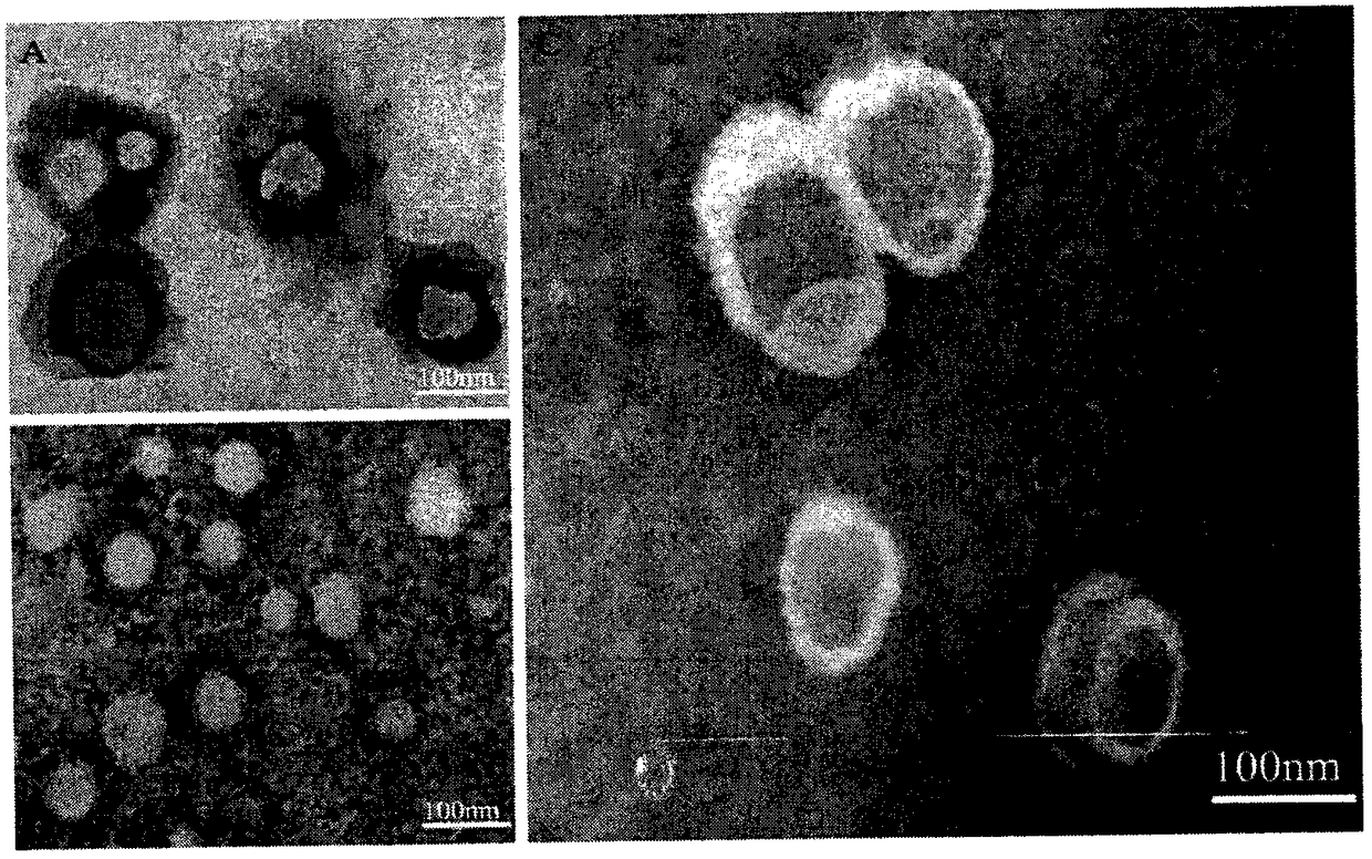 Preparation and applications of biologically camouflaged targeting nano drug delivering system for treating ischemic cerebral stroke