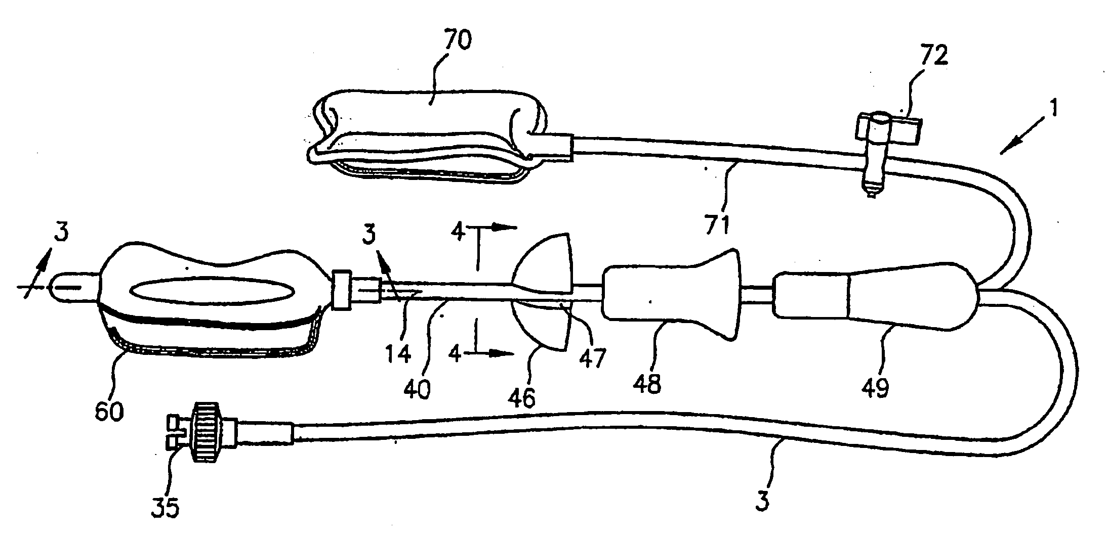 Intracavity probes and interfaces therefor for use in obtaining images and spectra of intracavity structures using high field magnetic resonance systems