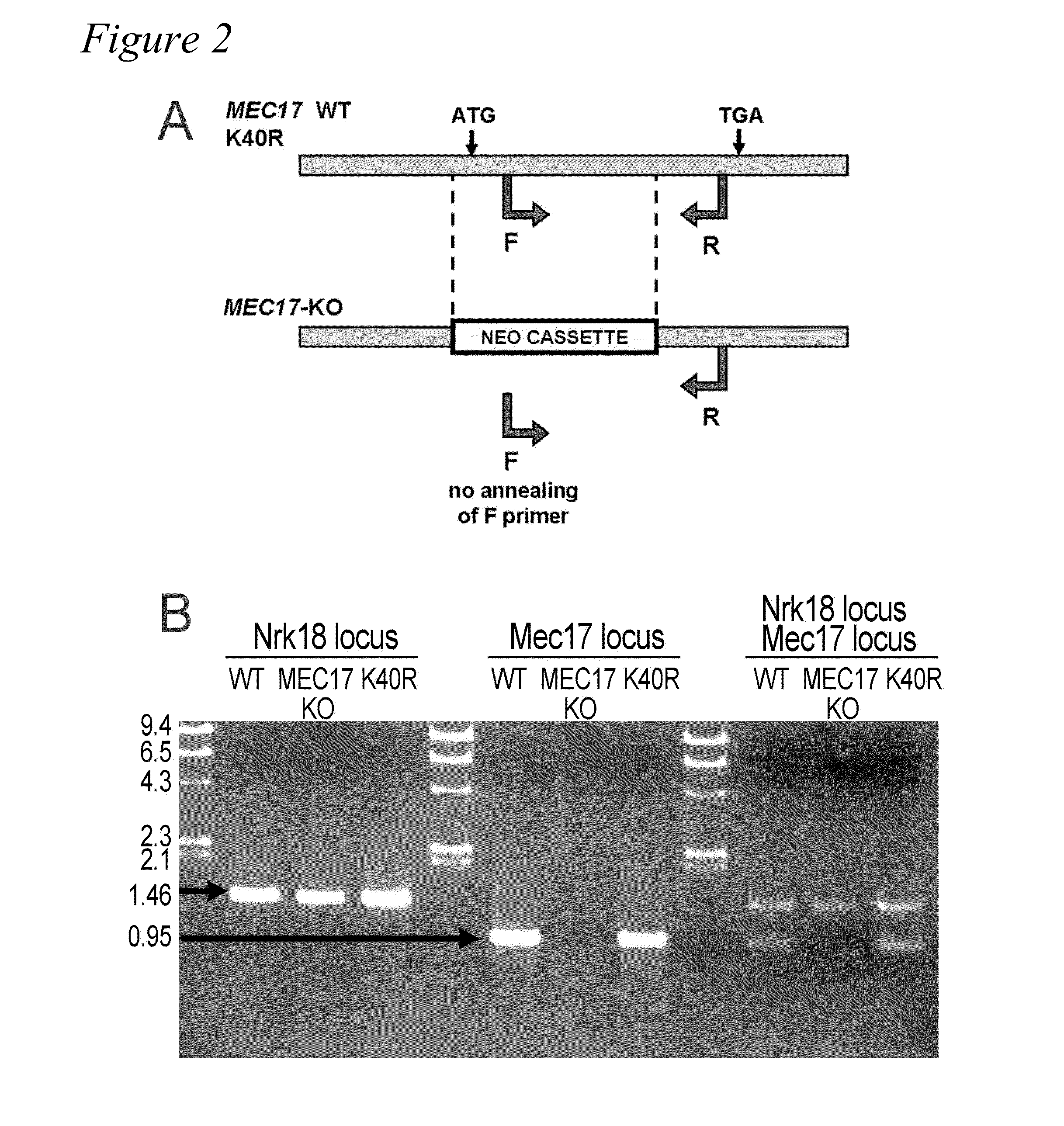 Alpha-tubulin acetyltransferase