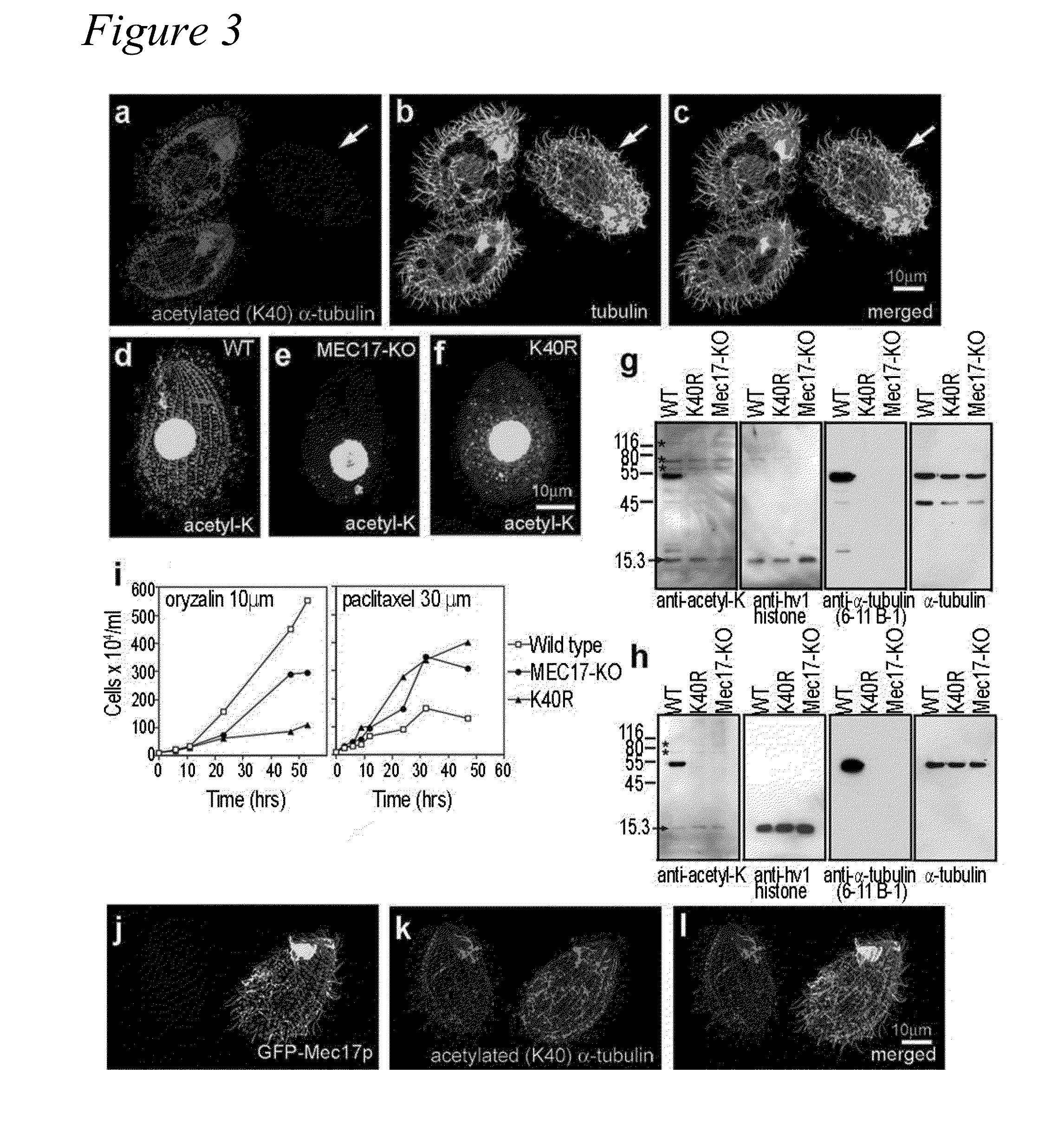 Alpha-tubulin acetyltransferase