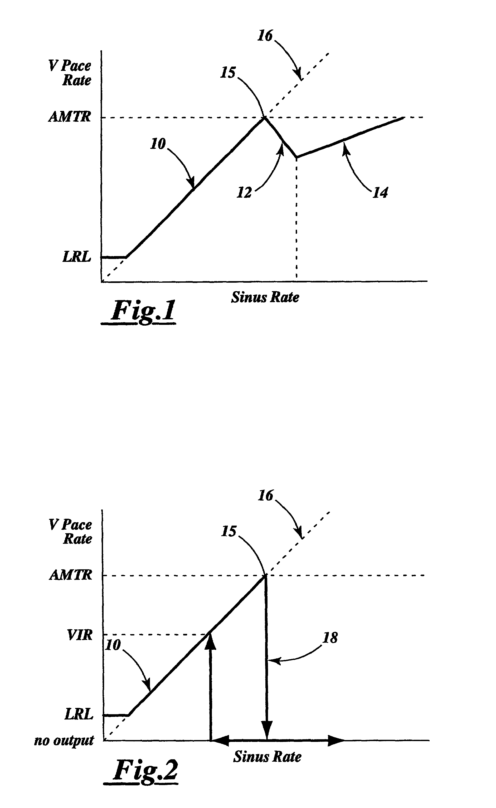 Device and method for ventricular tracking and pacing