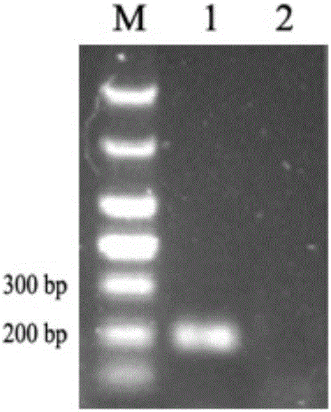 Detection primers of acinetobacter lwoffii and fluorescent quantitative PCR detection method