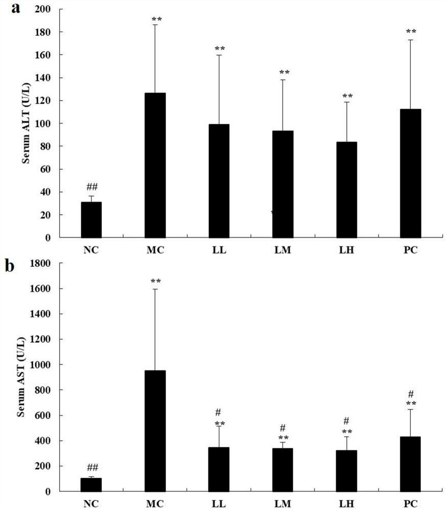 Application of Liquidamia hordgsonii Hook. polysaccharide in preparation of drugs for treating and/or preventing liver diseases